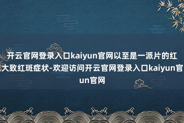 开云官网登录入口kaiyun官网以至是一派片的红点大致红斑症状-欢迎访问开云官网登录入口kaiyun官网